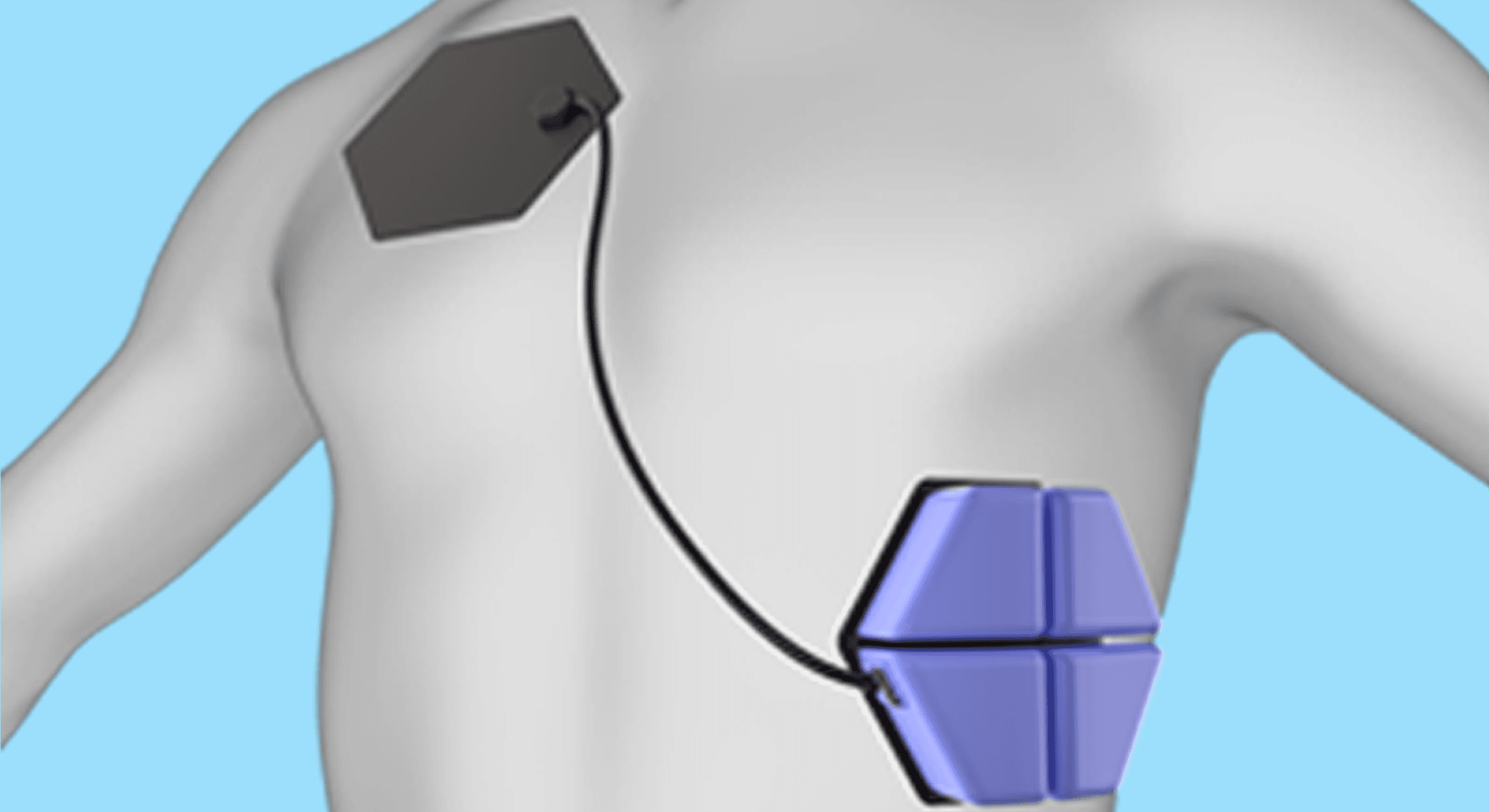 Wearable Device003